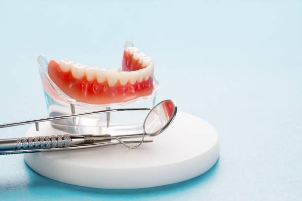 Dental Inlays and Onlays in Richmond, VA